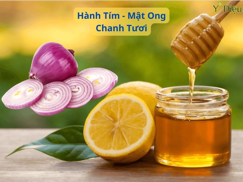 Siro hành tím trị ho làm từ hành tím, mật ong và chanh tươi.